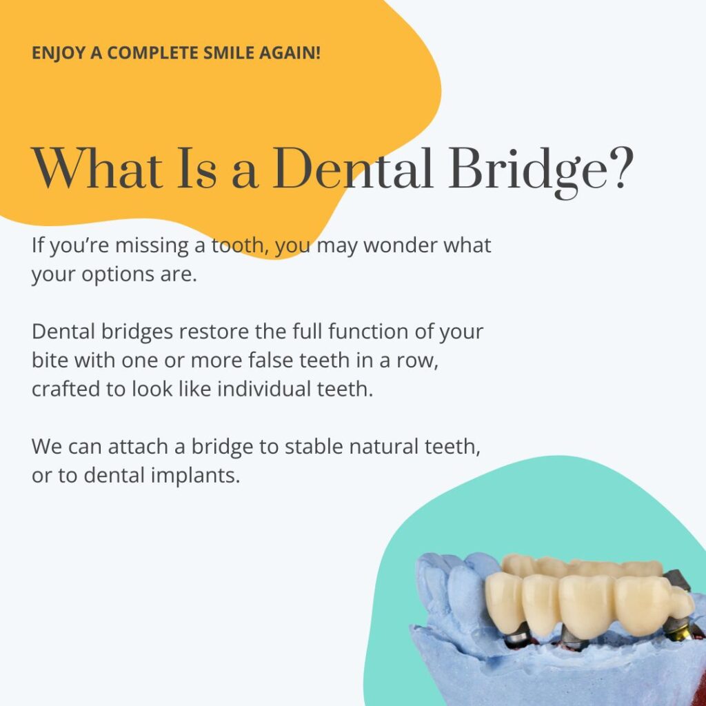 Image shows an example of an implant-supported dental bridge and explains how we can rebuild your smile with dental bridges in Sebastopol.